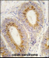 Methionyl tRNA Synthetase Antibody (C-term)